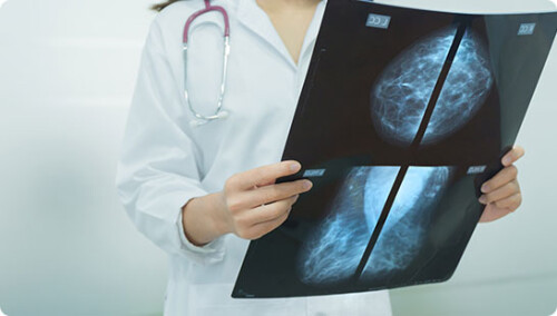 Breast Cancer Screening and Diagnosis by Melanie Seah